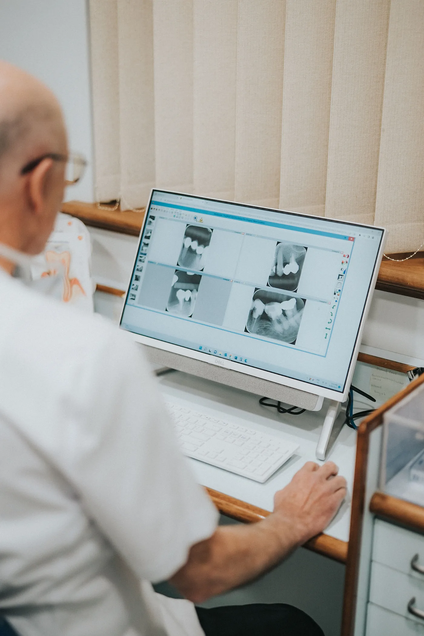 Dentures options being explained after a dental check